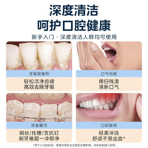 美的（Midea）BJ0301 冲牙器 洗牙器 水牙线 预防牙结石 可拆卸水箱 礼物 家用正畸喷嘴 小米白（1） 商品图2