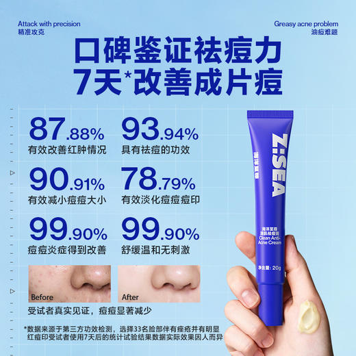 商城【男士面护】海洋至尊清肌祛痘膏淡化痘印青春豆豆收缩毛孔闭口粉刺凝胶 商品图1