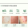可复美小绿膜 净痘修护膜 双酸修护 温和控痘 小绿膜5片/盒 商品缩略图2