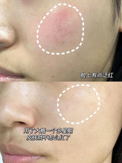 HR 赫莲娜绿宝瓶精华露50ml/100ml 修护抗氧面部精华液补水 新款 商品图4