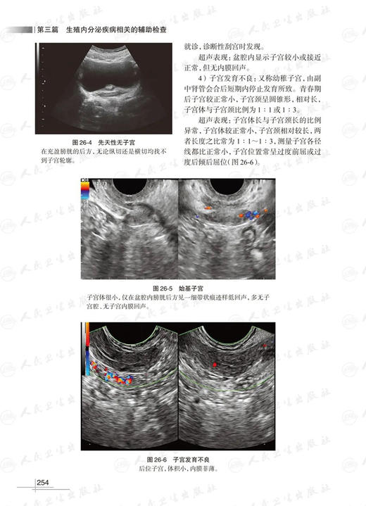 生殖内分泌疾病检查项目选择及应用 第3版 杨冬梓主编 临床泌尿生殖内分泌专科工作者必备工具书 人民卫生出版社9787117352017 商品图4