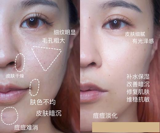 【清仓好价】智利COESAM经典蔷薇果精油15ml*2（效期至24.1） 商品图1