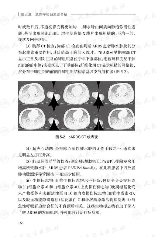 儿科急诊与危重症诊疗规范 第2版 附临床实操视频 儿科疾病诊疗规范丛书 刘春峰 宋国维 行业诊治规范9787117352215人民卫生出版社 商品图4