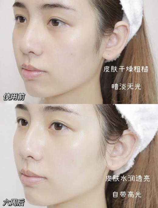 【清仓好价】智利COESAM经典蔷薇果精油15ml*2（效期至24.1） 商品图3