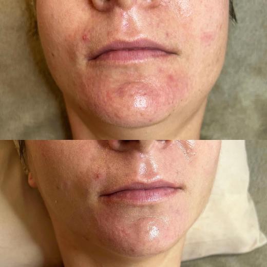 BR宝黎研萃 舒缓呵护专研面霜 商品图3