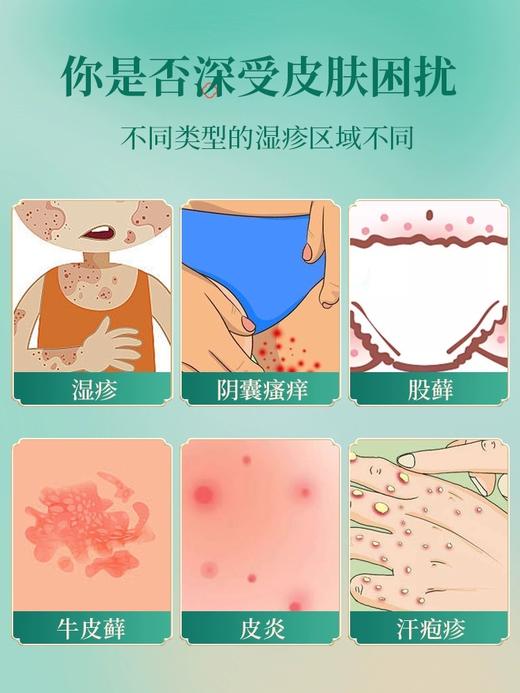 【品牌方直销】云南本草皮肤液体敷料成人痤疮膏水泡湿疹止痒去外用顽固皮炎 商品图1