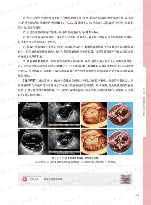妇产科超声诊断学 第2版 第二版 谢红宁 女性盆腔超声解剖检查方法妇产超声诊断妊娠胎儿畸形产前超声图谱书籍 人民卫生出版社 商品图4