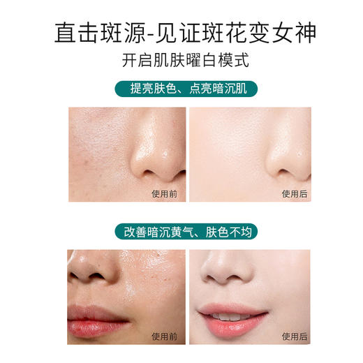 【美白臻颜】柏肤源 377美白祛斑面贴膜 商品图3