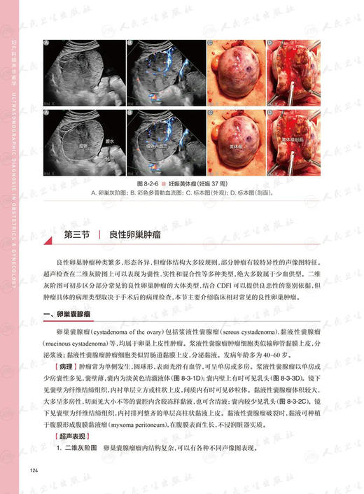 妇产科超声诊断学 第2版 第二版 谢红宁 女性盆腔超声解剖检查方法妇产超声诊断妊娠胎儿畸形产前超声图谱书籍 人民卫生出版社 商品图3