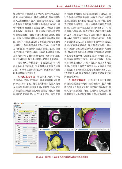 医学3D打印原理与技术 戴尅戎 卢秉恒 十三五规划 专科医师核心能力提升导引丛书 供专业学位研究生及专科医师用 人民卫生出版社 商品图4