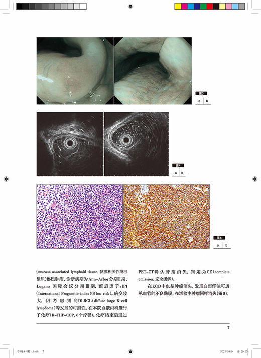 胃与肠 群体性胃镜筛查的现状及存在问题 胃与肠翻译委员会译 消化内科医师专业性图书胃镜检研究9787559130952辽宁科学技术出版社 商品图4