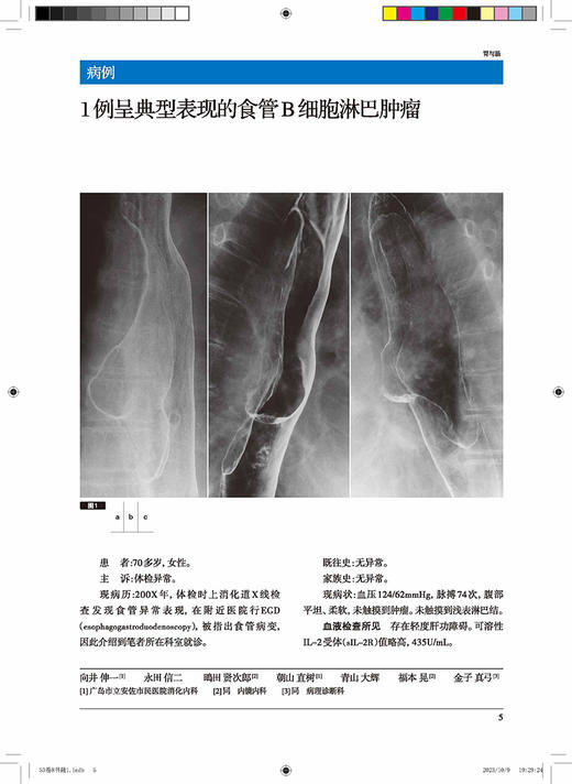 胃与肠 群体性胃镜筛查的现状及存在问题 胃与肠翻译委员会译 消化内科医师专业性图书胃镜检研究9787559130952辽宁科学技术出版社 商品图3