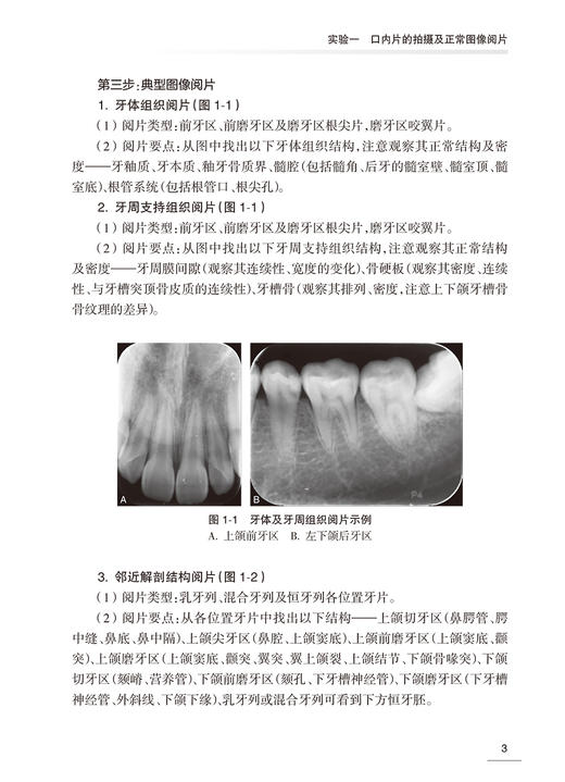 口腔颌面医学影像诊断学实验教程 游梦 口腔本科教材配套实验教程 影像学检查方法 常见疾病影像诊断 人民卫生出版社9787117354233 商品图3