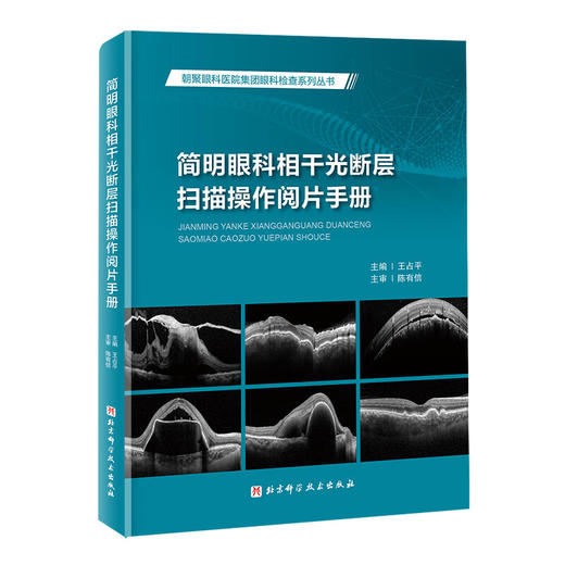 简明眼科相干光断层扫描操作阅片手册 王占平 朝聚眼科医院集团眼科检查系列丛书 OCT影像技术基本操作指导 北京科学技术出版社 商品图1