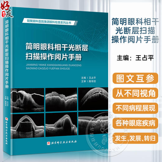 简明眼科相干光断层扫描操作阅片手册 王占平 朝聚眼科医院集团眼科检查系列丛书 OCT影像技术基本操作指导 北京科学技术出版社 商品图0