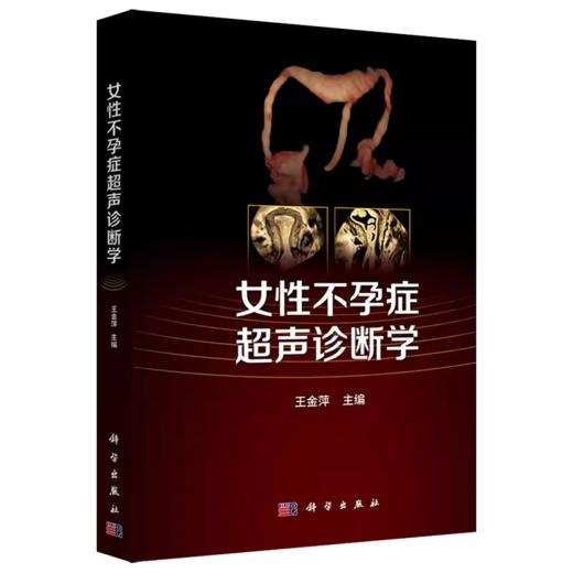 女性不孕症超声诊断学 王金萍 女性生育流产超声检查不孕症原因筛查评估经腹部子宫卵巢输卵管检查超声医学妇产科妇科超声造影 商品图1