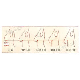  来聊聊，你从什么时候开始“下垂”的？ 