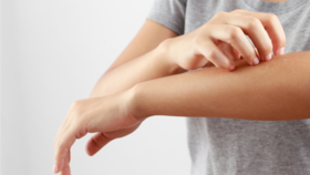 秋天洗澡后干痒难忍？是犯了这4个错！