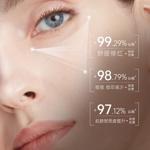 儒意油橄榄舒缓精萃露30ml  维稳修护肌肤屏障控油祛痘舒缓敏肌泛红 精华水 | 儒意官方商城 商品图4