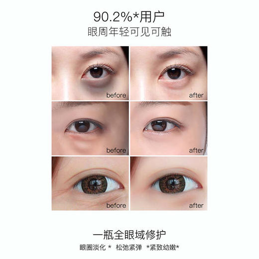 【眼部抗衰急先锋】薄美克眼部密集修护精华液15ml 商品图3