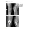 全膝关节翻修术 实用指南 商品缩略图3