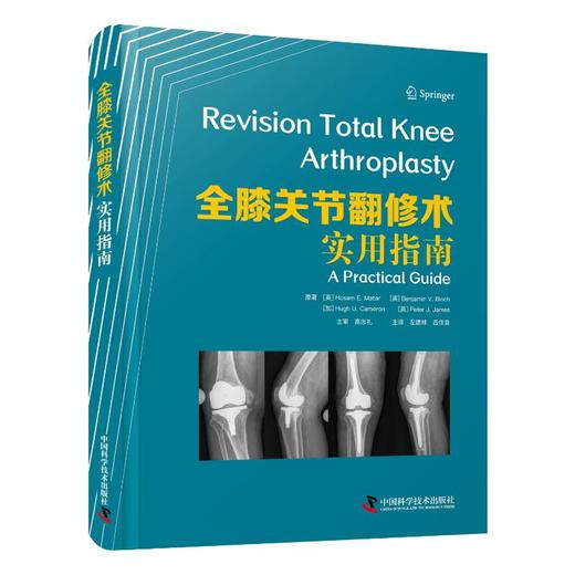 全膝关节翻修术 实用指南 商品图0