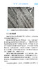 线粒体遗传病诊疗 商微主编 线粒体病诊断治疗功能障碍与相关疾病 遗传病阻断治疗研究全新进展 北京大学医学出版社9787565928734 商品缩略图4