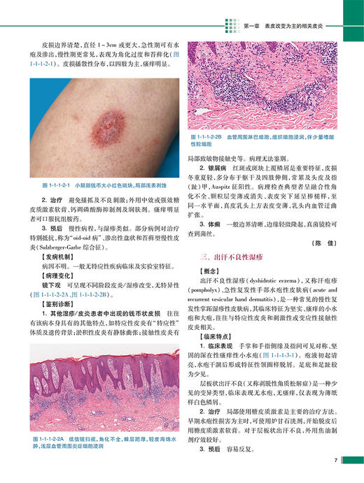 临床病理诊断与鉴别诊断 皮肤疾病 刘业强 薛汝增 炎症肿瘤皮肤病临床病例 典型病理特点鉴别诊断要点9787117355360人民卫生出版社 商品图3