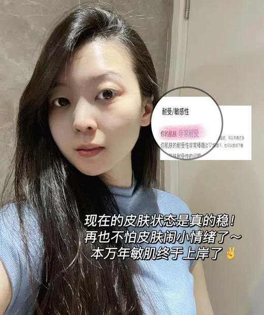 皮宝舒缓修护特护霜50g屏障受损泛红敏感肌退红 商品图6