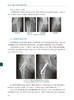 机器人辅助创伤骨科手术技巧 蒋协远 王军强 机器人背景原理操作技术 天玑骨科手术机器人进行常见手术标准操作流程人民卫生出版社 商品缩略图4