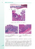 病理学 第4版 附视频习题 周桥 十四五规划全国高等学校教材 供八年制及5+3一体化临床医学等专业用 人民卫生出版社9787117352949 商品缩略图3