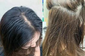 换季头皮瘙痒、长痘、刺痛……敏感？原来是这里出了问题！