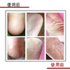 女士松口防裂袜足跟型 中筒袜 纯色乳胶防裂四季款棉袜 缓解干裂脚跟疼痛 告别脚裂脚干烦恼 5双/盒装 商品缩略图1