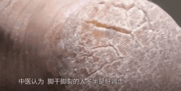 去年爆卖20W瓶的手足霜，每天一涂一抹，皮肤滋养渗透，重回水润！
