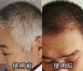 一梳一洗，20分钟快速变黑，这个不到100元的神器，让你年轻漂亮10岁！