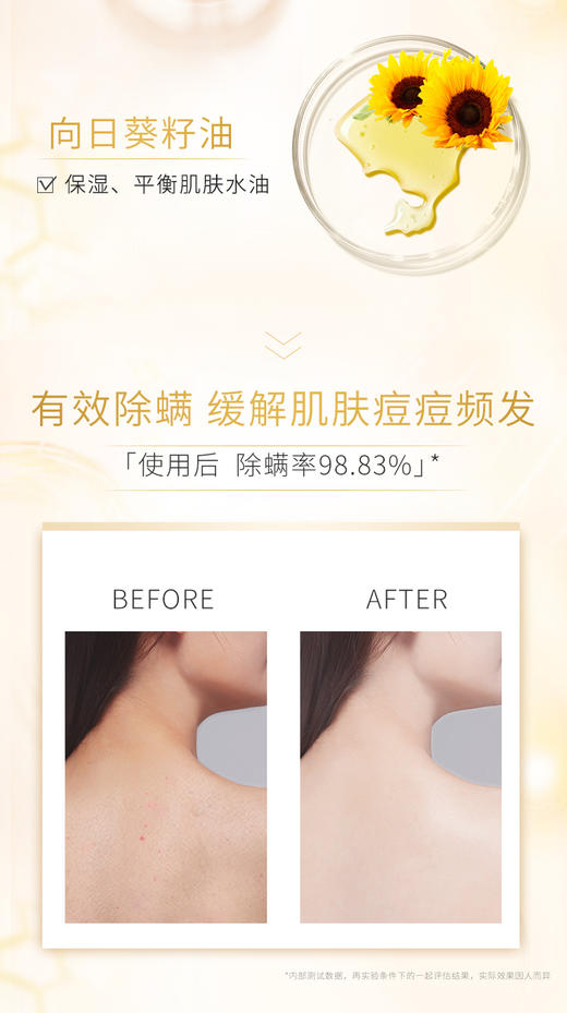 【除螨止痒】米蓝希矿物硫磺沐浴露 400ml 商品图6