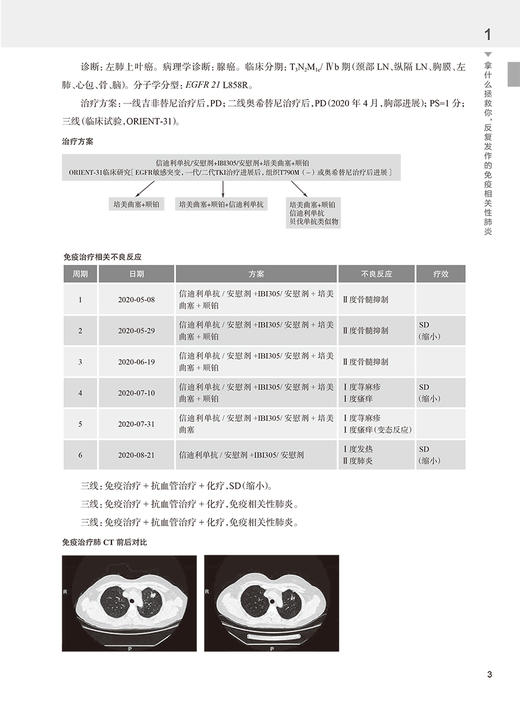肿瘤免疫治疗思路及用药安全 张力 临床典型病例诊疗解析 免疫检查点抑制剂使用irAEs管理规范解读 人民卫生出版社9787117352666 商品图4