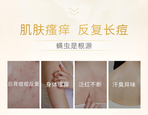 【除螨止痒】米蓝希矿物硫磺沐浴露 400ml 商品图3