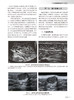中华肌骨超声学 朱家安 邱逦 肌骨超声基本原理检查技术方法临床应用解剖研究进展 中华临床影像库 人民卫生出版社9787117352994 商品缩略图3