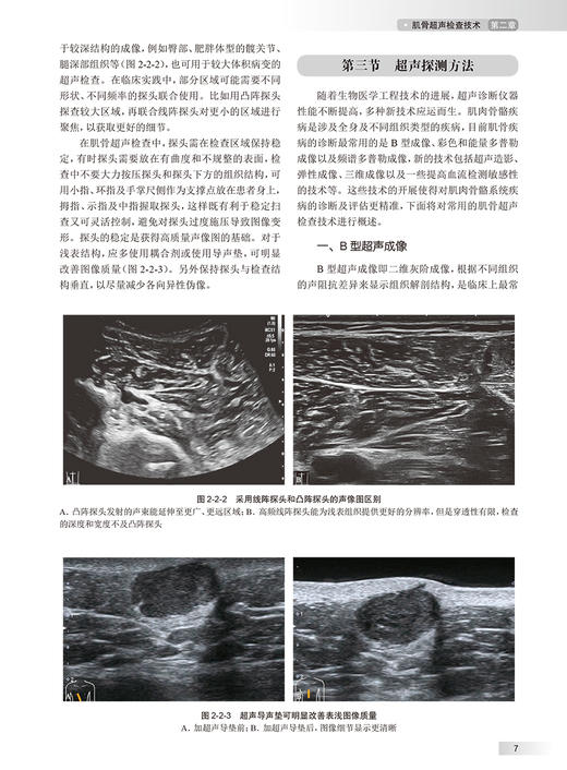 中华肌骨超声学 朱家安 邱逦 肌骨超声基本原理检查技术方法临床应用解剖研究进展 中华临床影像库 人民卫生出版社9787117352994 商品图3
