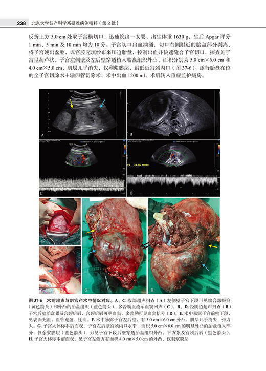 北京大学妇产科学系疑难病例精粹 第2辑 乔杰 王建六 杨慧霞 妇产生殖内分泌经典疑难病例摘要诊疗经过思路分析北京大学医学出版社 商品图3