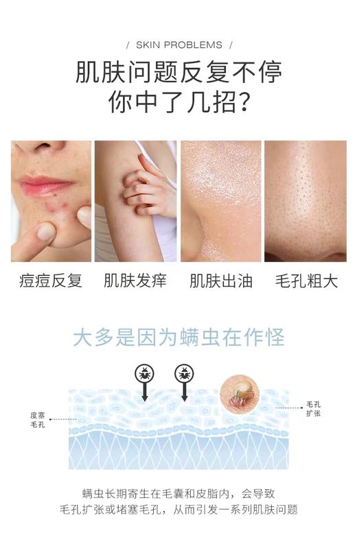 米蓝希矿物硫磺皂125g控油祛痘 除螨，可洗脸 洗澡 商品图2