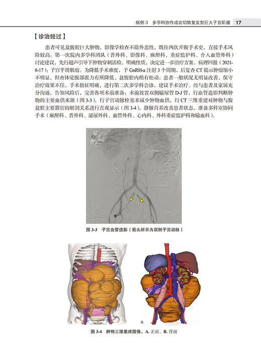 北京大学妇产科学系疑难病例精粹 第2辑 乔杰 王建六 杨慧霞 妇产生殖内分泌经典疑难病例摘要诊疗经过思路分析北京大学医学出版社 商品图2