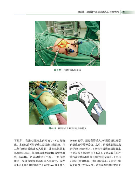 泌尿外科微创技术创新与改良 北大泌尿所技术 附手术视频 周利群等编 常见泌尿外科手术与检查规范系统化指导 北京大学医学出版社 商品图3