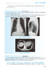 正版 外科学 胸心外科分册 第2版 胡盛寿 王俊主编 国家卫生健康委员会住院医师规范化培训规划教材 人民卫生出版社9787117343046 商品缩略图3