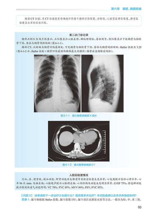 正版 外科学 胸心外科分册 第2版 胡盛寿 王俊主编 国家卫生健康委员会住院医师规范化培训规划教材 人民卫生出版社9787117343046 商品图3