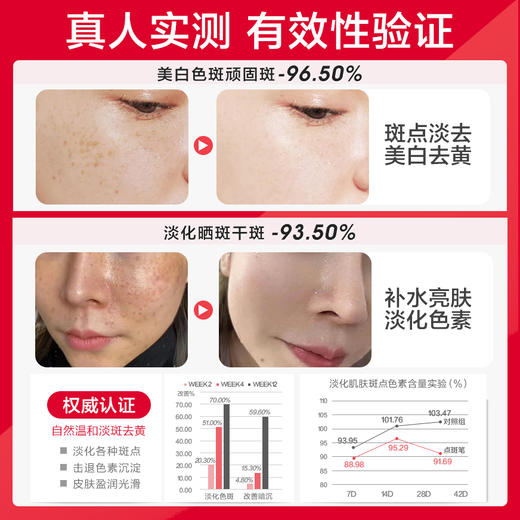 【微信会员专享限时抢】【药监特证】臻奢美白淡斑精华液祛除顽固斑雀斑黄褐斑老年斑补水保湿女点斑笔 商品图1