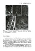 脊柱与关节射频消融治疗技术 樊碧发等译 脊柱关节疾病常见疼痛射频治疗方法操作技术要点影像学 北京大学医学出版社9787565930089 商品缩略图3