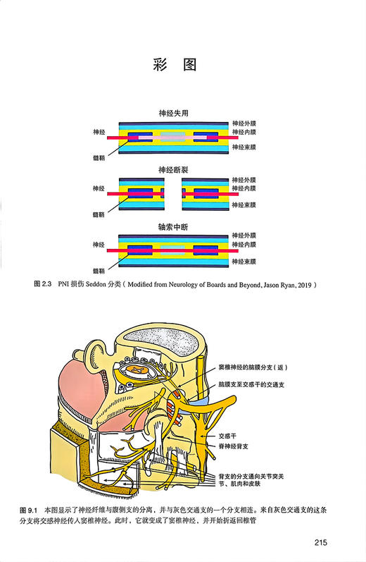 脊柱与关节射频消融治疗技术 樊碧发等译 脊柱关节疾病常见疼痛射频治疗方法操作技术要点影像学 北京大学医学出版社9787565930089 商品图4