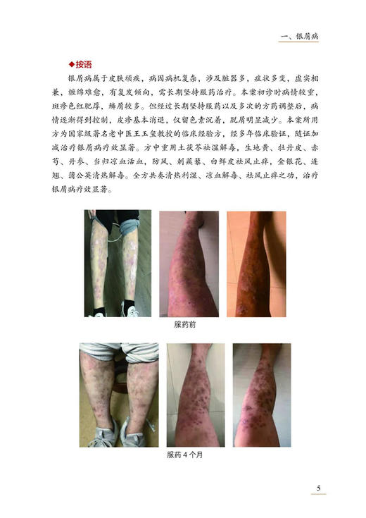 王学军皮肤病医案选 王学军 张雅丽 王放 临床常见病种经典案例中医诊疗思路 辨证论治经方应用调治 中医古籍出版社9787515227016 商品图4